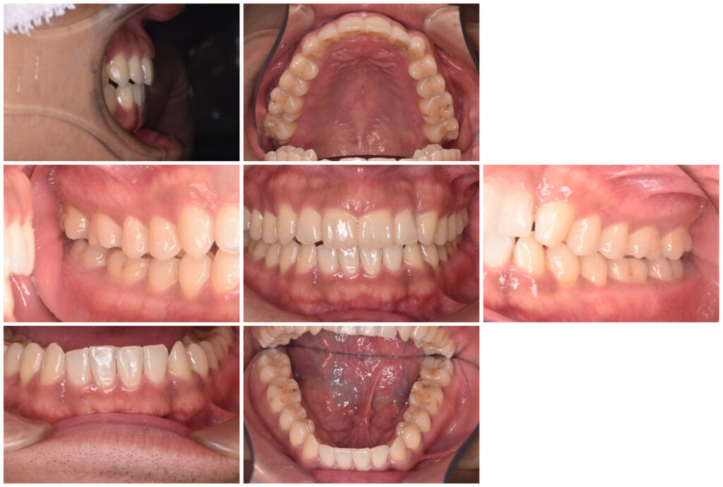 スタースマイル矯正「歯科矯正の窓口」 8 スタースマイル矯正「歯科矯正の窓口」 332 スタースマイル矯正「歯科矯正の窓口」