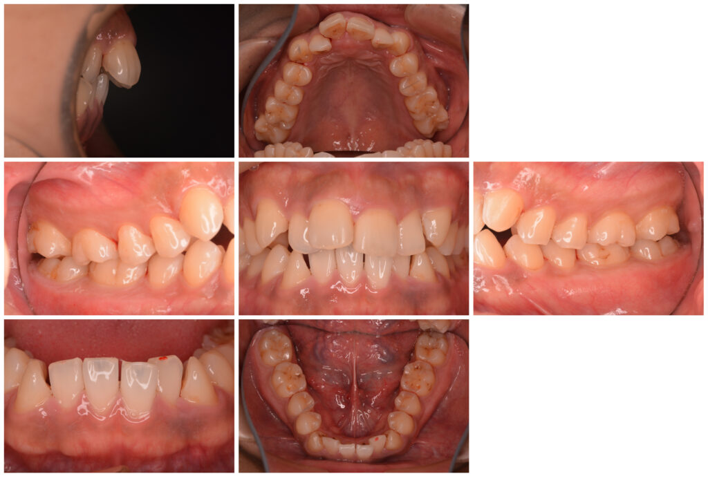 スタースマイル矯正「歯科矯正の窓口」 7 スタースマイル矯正「歯科矯正の窓口」 333 スタースマイル矯正「歯科矯正の窓口」